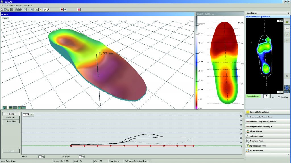 Software di analisi plantare con mappa di pressione colorata.
